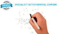 Clean Start Tattoo Removal – How does Laser Tattoo Removal Work-