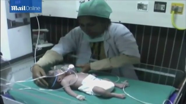 Elle accouche à l'hôpital, mais quand les docteurs voient le bébé, ils sont sous le choc!