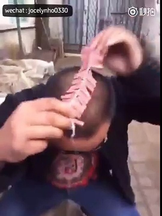 Blast in Head