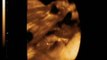 Luke Ryan Smith 29 week 4D ultrasound pt2