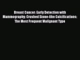Read Breast Cancer: Early Detection with Mammography: Crushed Stone-like Calcifications: The