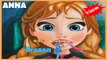 Anna Tooth Injury Doctor Games - Frozen Health Teeth Caring Game