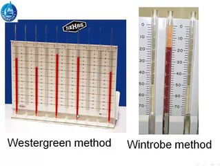 Erythrocyte sedimentation rate