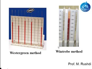 Erythrocyte sedimentation rate (lecture)