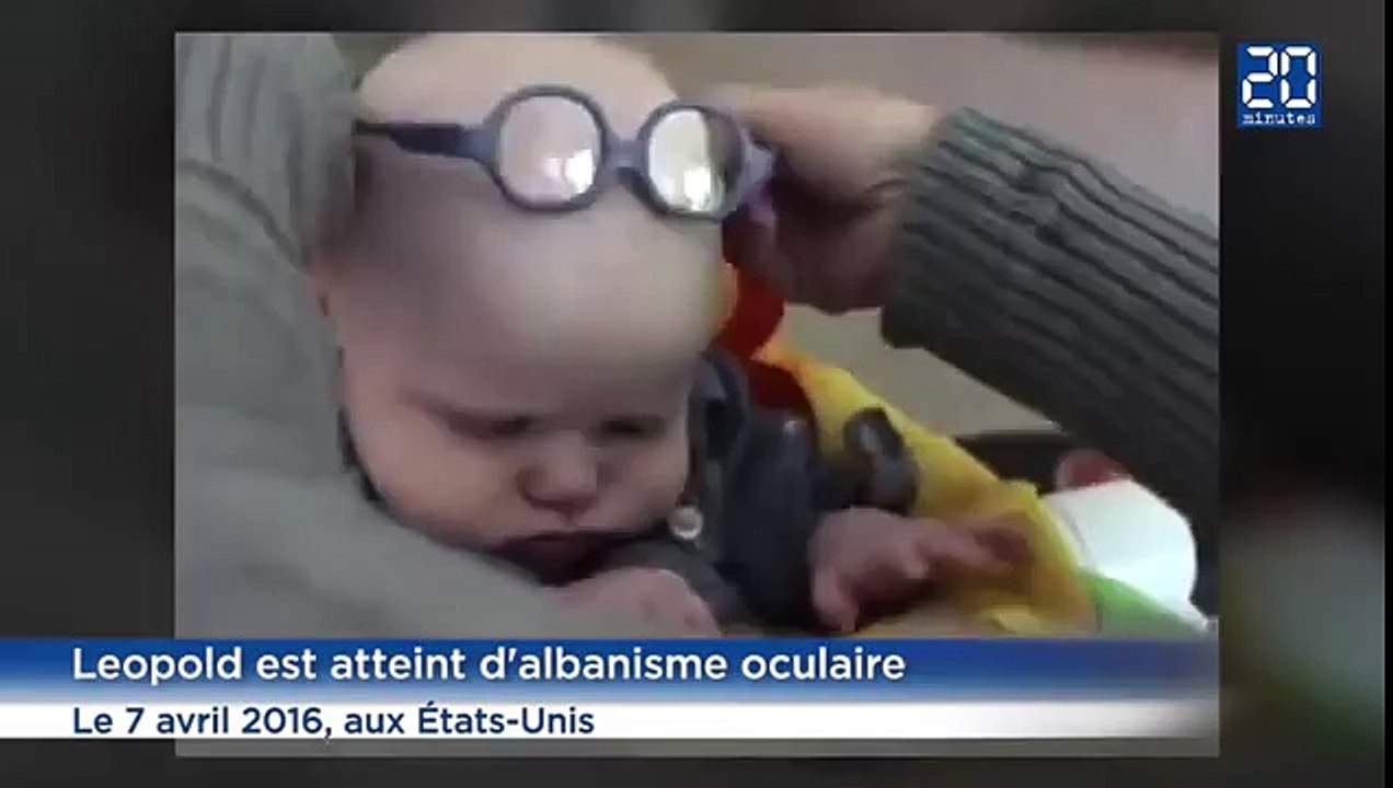 Vous serez ÉMU devant ce bébé malvoyant qui voit sa maman pour la première fois