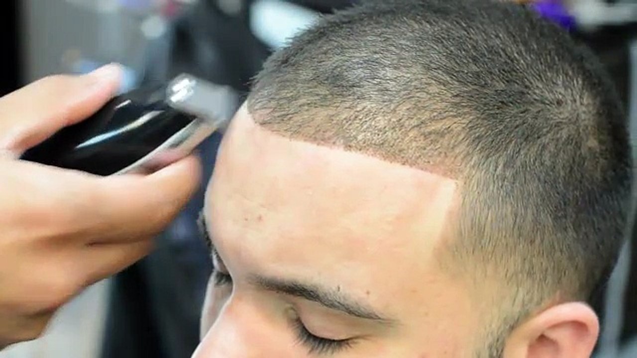 How to fix balding hair! cover up bald spots, receding hairlines, and thinning hair!