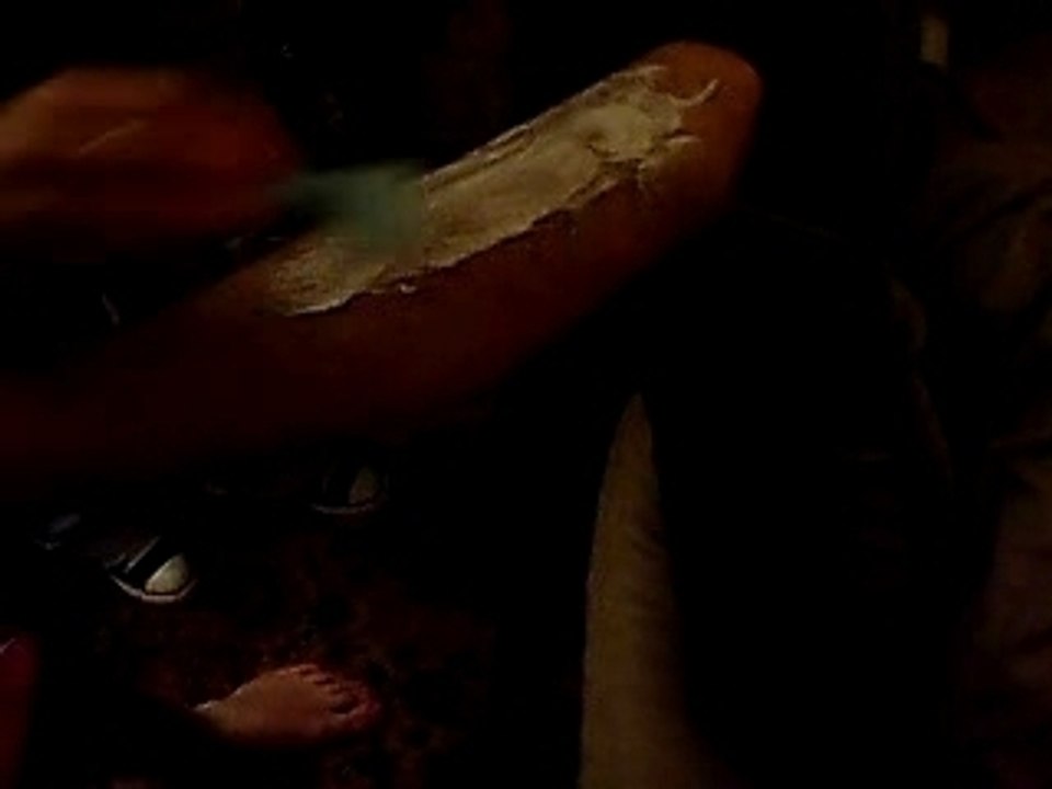 épilation de fazo 1/2