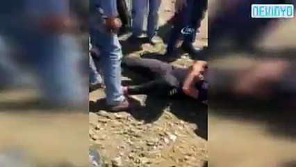 Kaza Süsü Veren Genç Sevgilisine Evlenme Teklif Etti
