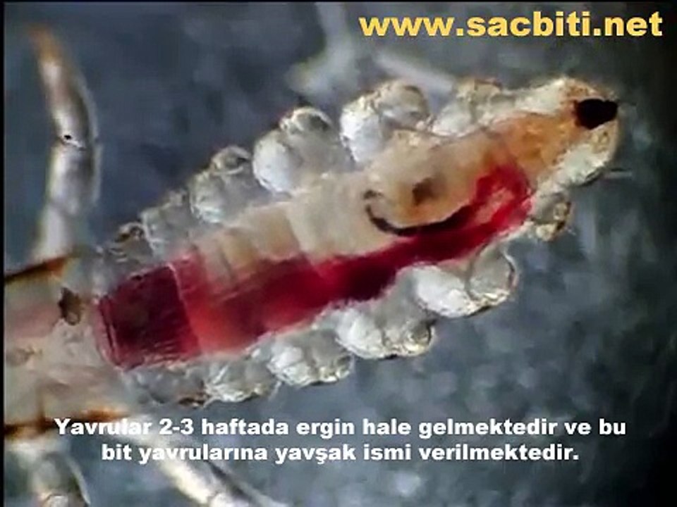 Saç Biti Nasıl Olur ? Mikroskopla Yakın Görüntü