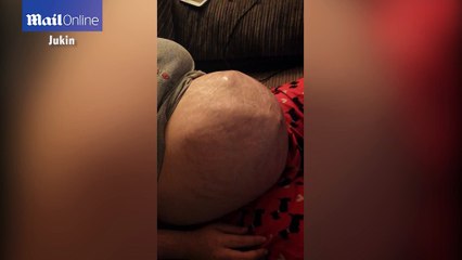 Incredible video shows baby wriggle around inside woman's belly
