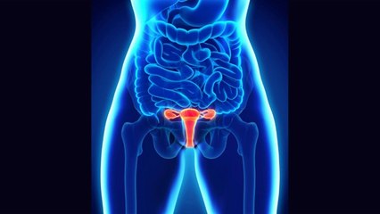 Endométriose : du diagnostic au traitement