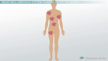 Nervous System Tumors: Gliomas, Meningiomas, and More