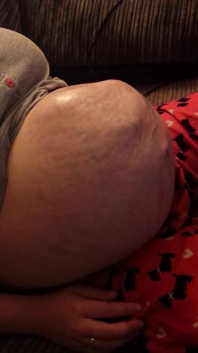 Baby moving in belly kicking and sticking legs out Pregnancy