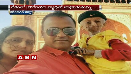 15-Year-Old Nihal Bitla, The Face Of Progeria In India, Passes Away In Telangana
