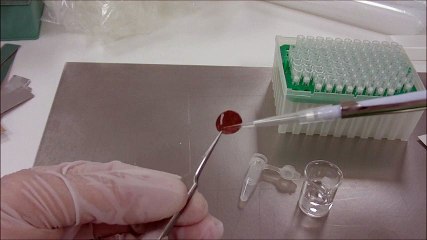 dried blood spots on protein microarrays