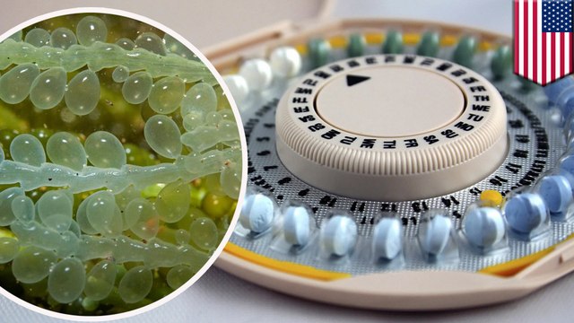 Sperm-catching beads could be a new form of birth control without the hormonal side effects of the pill