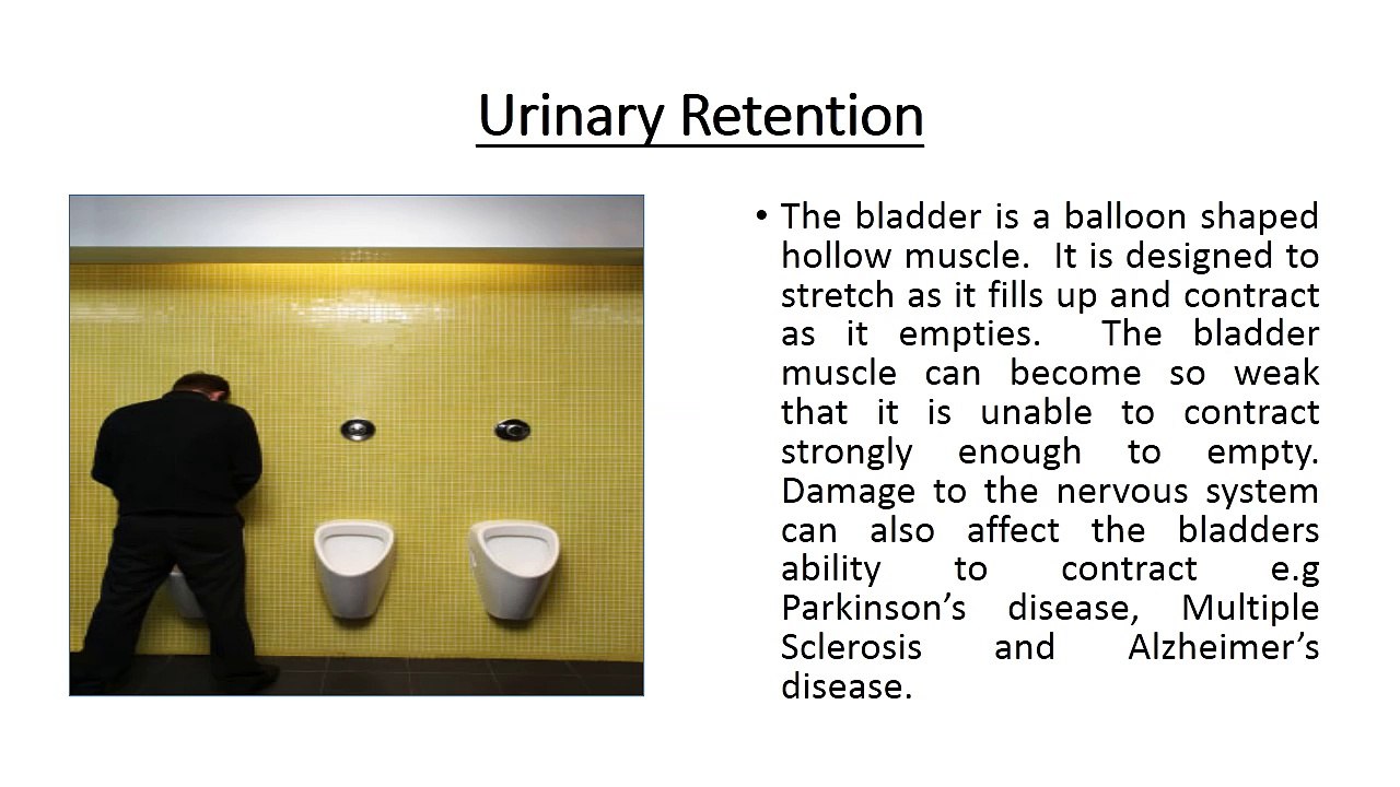 Urinary Retention