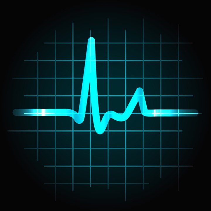 How to read an Ectrocardiogram (ECG) and discover what is happening in the heart during the P, QRS, and T waves