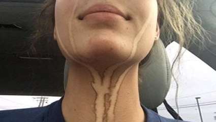 Bronzlaştıktan Sonra Ağlayan Kızın Fotoğrafı Rekor Kırdı