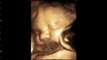 Hayden Baby Boy 29 wks, 2 days 4D Sonogram....More