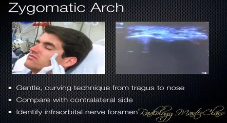13- Head and Neck Ultrasound