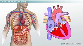 Heart Failure: The Left Heart, Lungs, & Etiology