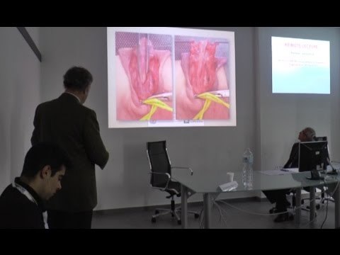 Napoli - Urologia pediatrica, esperti da tutto il mondo a confronto (05.05.16)