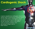 What Are the Signs and Symptoms of Cardiogenic Shock?