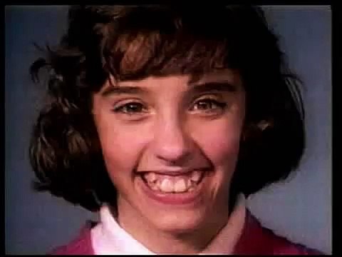 Ecco cosa succede ai denti dopo 18 mesi con l'apparecchio!