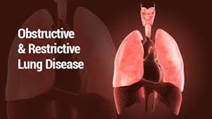 Restrictive ventilatory defects(Restrictive Lung Disease)