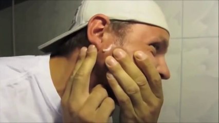 Espinha mais nojenta do Mundo2