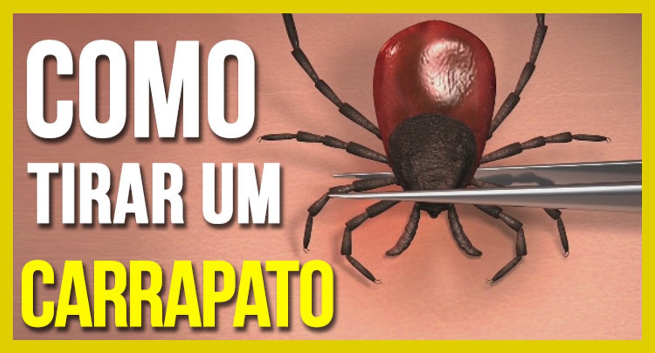 Como tirar Carrapato em 3 passos - Simples e Rápido