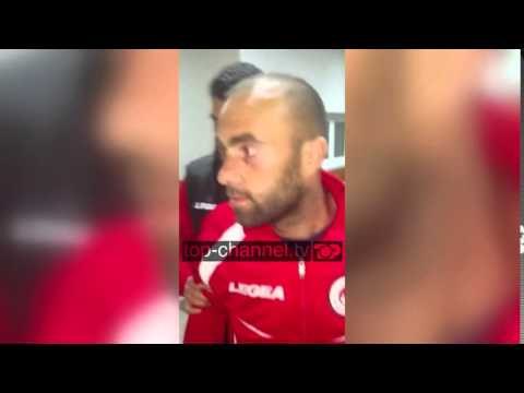 Futbollisti i Kastriotit pas dhunës në Dibër (PA KOMENT) - Top Channel Albania - News - Lajme