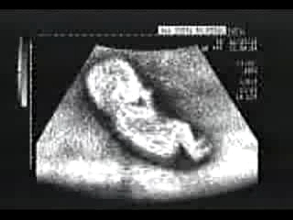 Michael Schumacher bébé