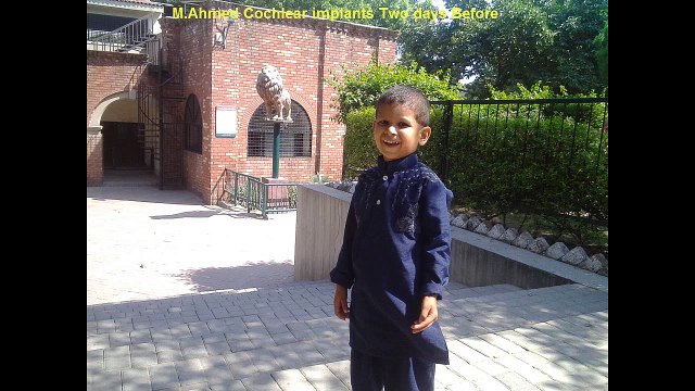 Cochlear implants:Some Pics & Videos of M.Ahmed Exactly Two days Before Cochlear implant