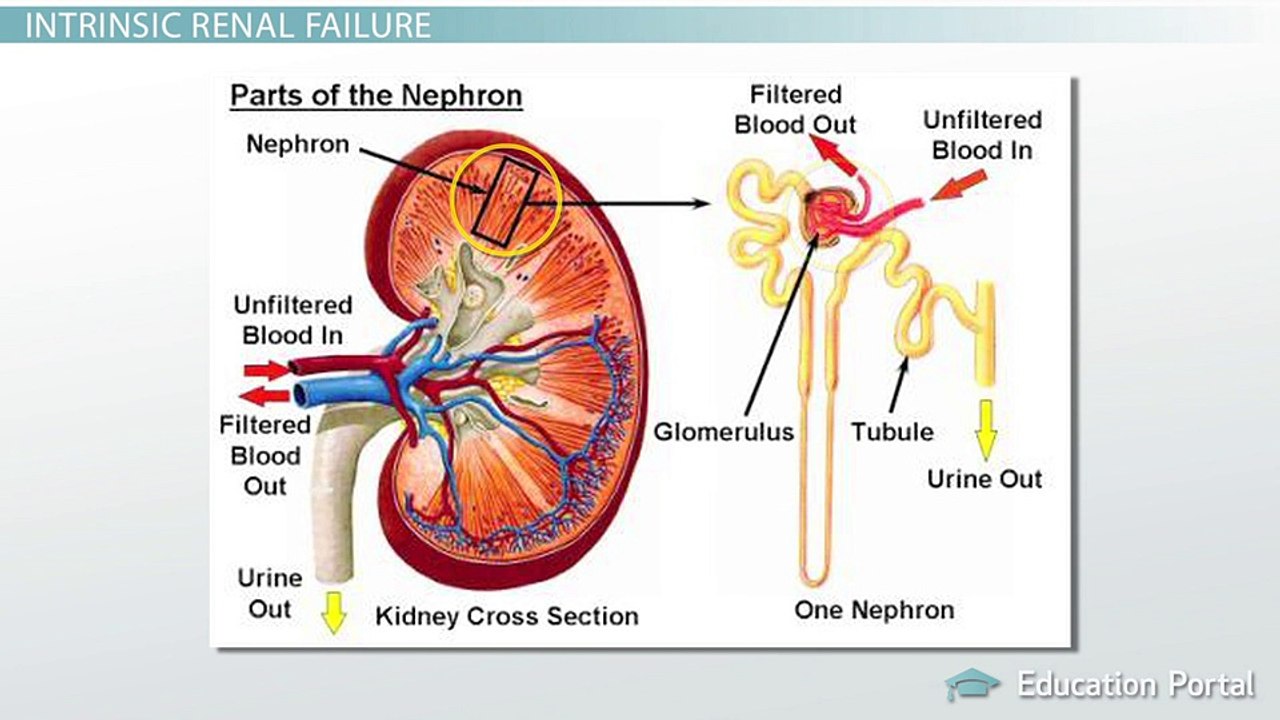 Acute Renal Failure - Intrinsic Renal Failure & Its Consequences