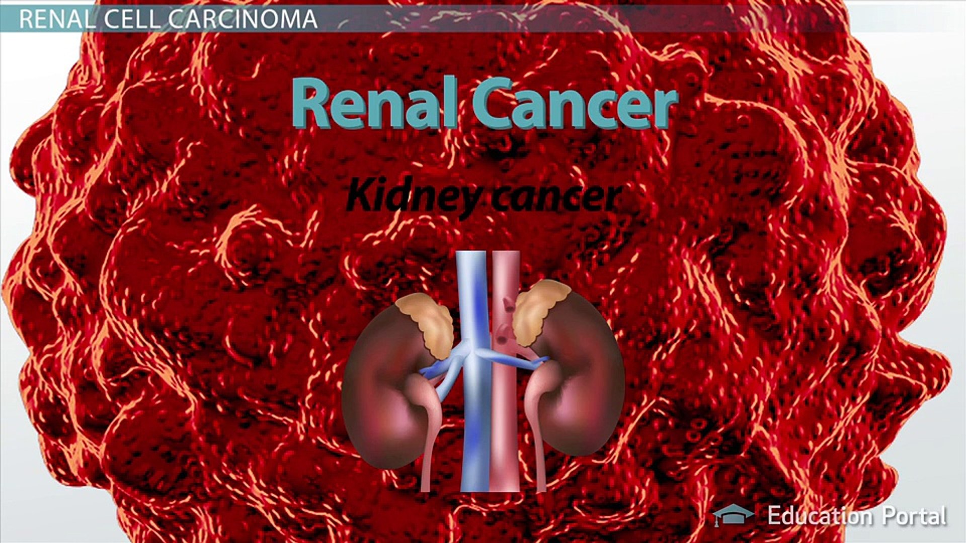 Renal Cancer: Causes & Symptoms