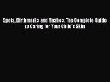 Download Spots Birthmarks and Rashes: The Complete Guide to Caring for Your Child's Skin PDF