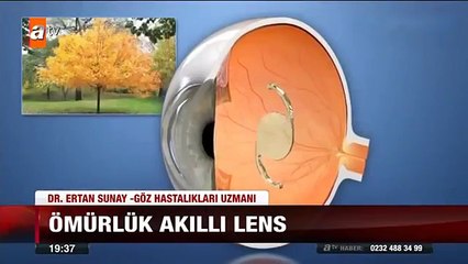 Op.Dr. Ertan Sunay ATV Ana Haber Akıllı Lensler