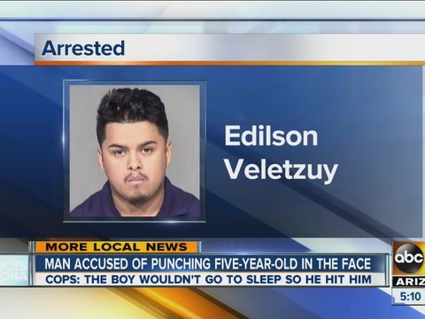 Man accused of punching five-year-old in face