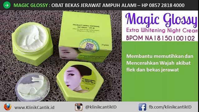 Obat Bekas Jerawat yang Ampuh di Apotik, 0857 2818 4000