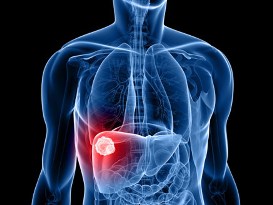 Liver problems Symptoms