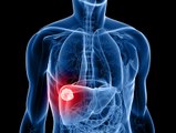 Liver problems Symptoms