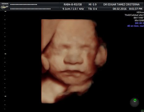 Ultrasonido 4D HD Live Embarazo de 29 semanas