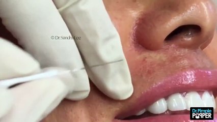 Popular Videos - Milium