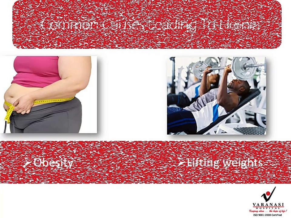 Are you suffering from hernia? Cure hernia through Laparoscopic Hernia surgery