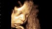 The 3D/4D ultrasound scans capture video