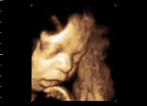 The 3D/4D ultrasound scans capture video