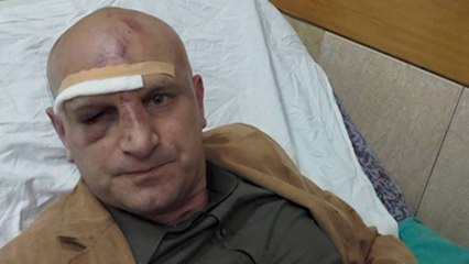 PRANGOSET PRESIDENTI I KLUBIT “KASTRIOTI” DHUNOI NJE GAZETAR SPORTIV NE TIRANE LAJM