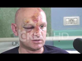 ARRESTOHET PRESIDENTI I KASTRIOTIT